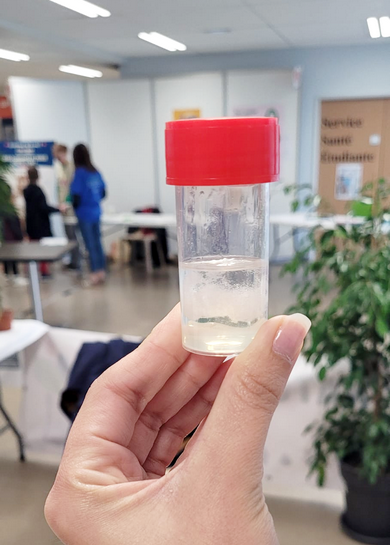 zoom sur l'ADN extrait zoom sur l'ADN extrait